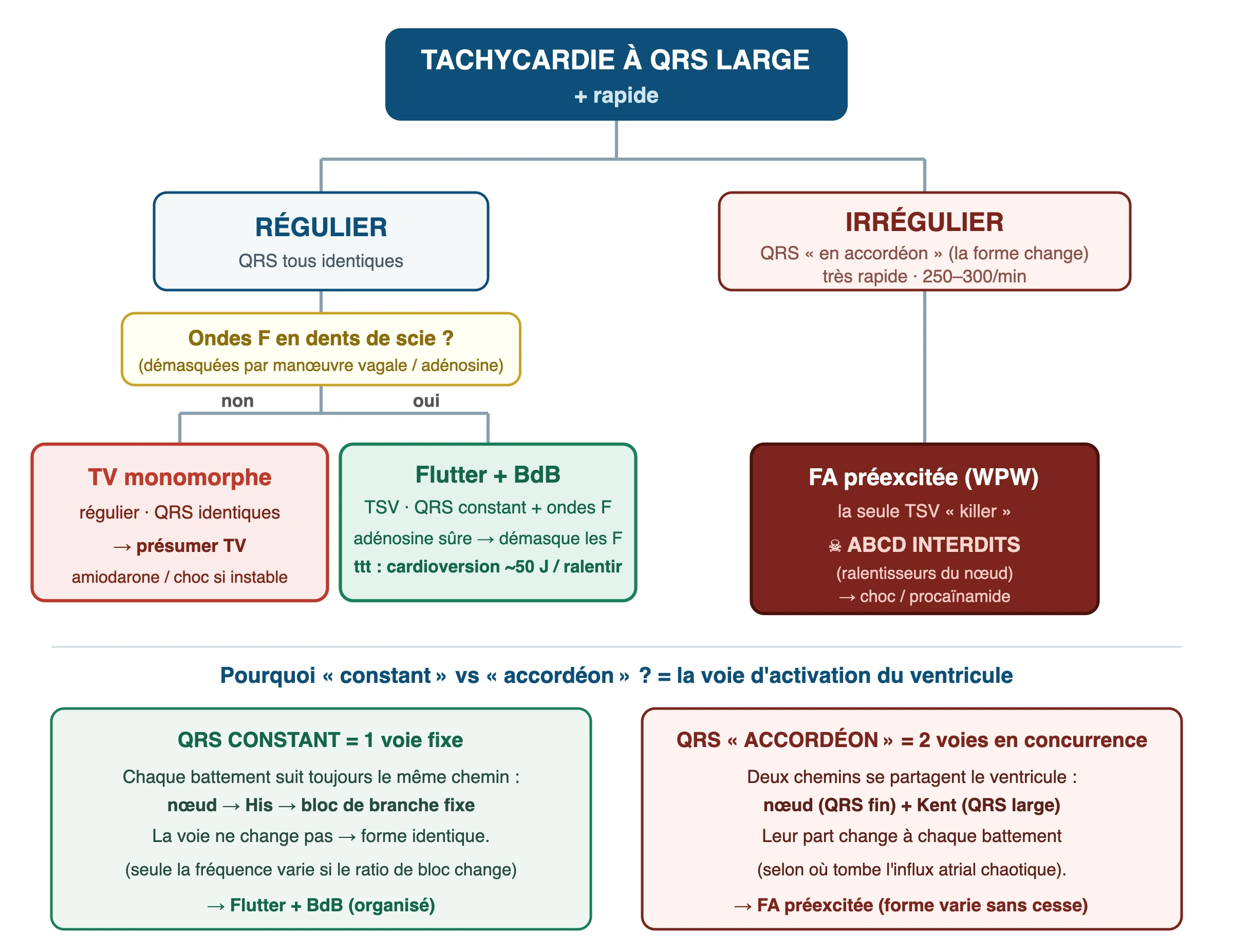 Arbre décisionnel des tachycardies à QRS large : d'abord régulier ou irrégulier. Régulier avec QRS tous identiques : chercher des ondes F en dents de scie (démasquées par manœuvre vagale ou adénosine) — absentes = TV monomorphe (présumer TV, amiodarone ou choc si instable), présentes = flutter avec bloc de branche (TSV, adénosine sûre pour démasquer les ondes F, traitement = cardioversion ou ralentissement). Irrégulier avec QRS en accordéon (forme qui change) à 250-300 par minute = FA préexcitée (WPW), la seule TSV killer, ABCD interdits (ralentisseurs du nœud), choc ou procaïnamide. Le QRS constant vient d'une seule voie fixe (nœud-His-bloc de branche fixe) = flutter+BdB ; le QRS en accordéon vient de deux voies en concurrence (nœud fin + Kent large) dont la part change à chaque battement = FA préexcitée.