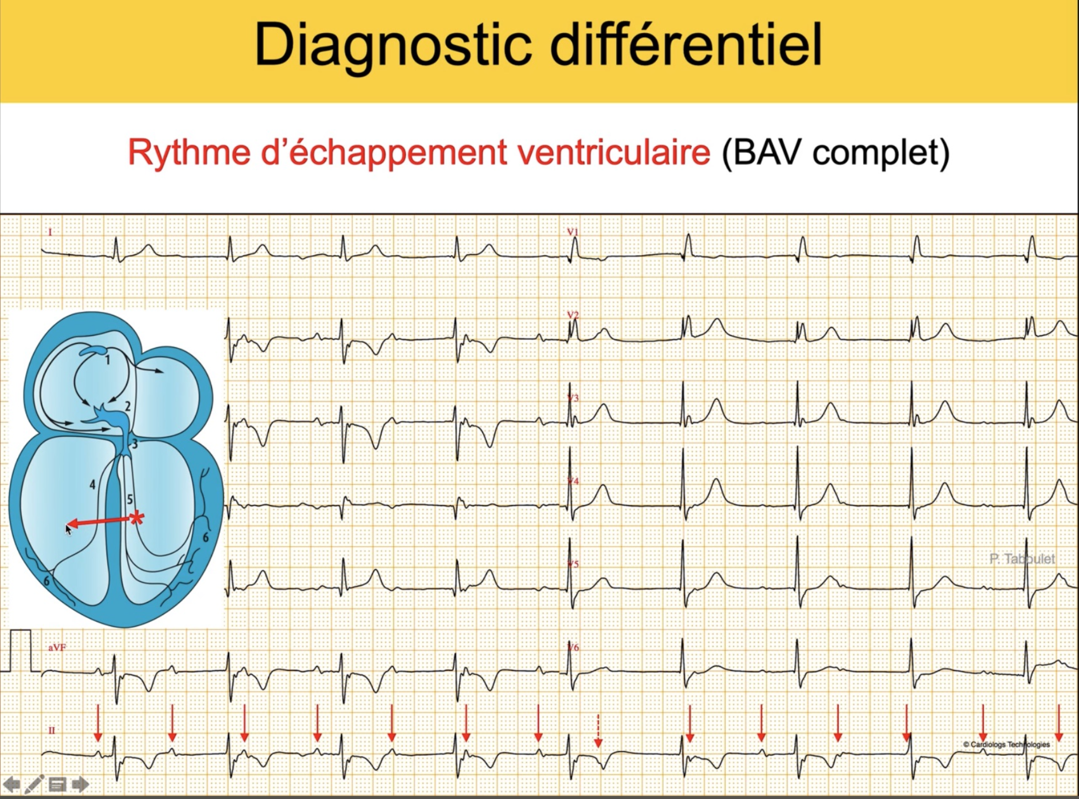 BAV complet — échappement VG