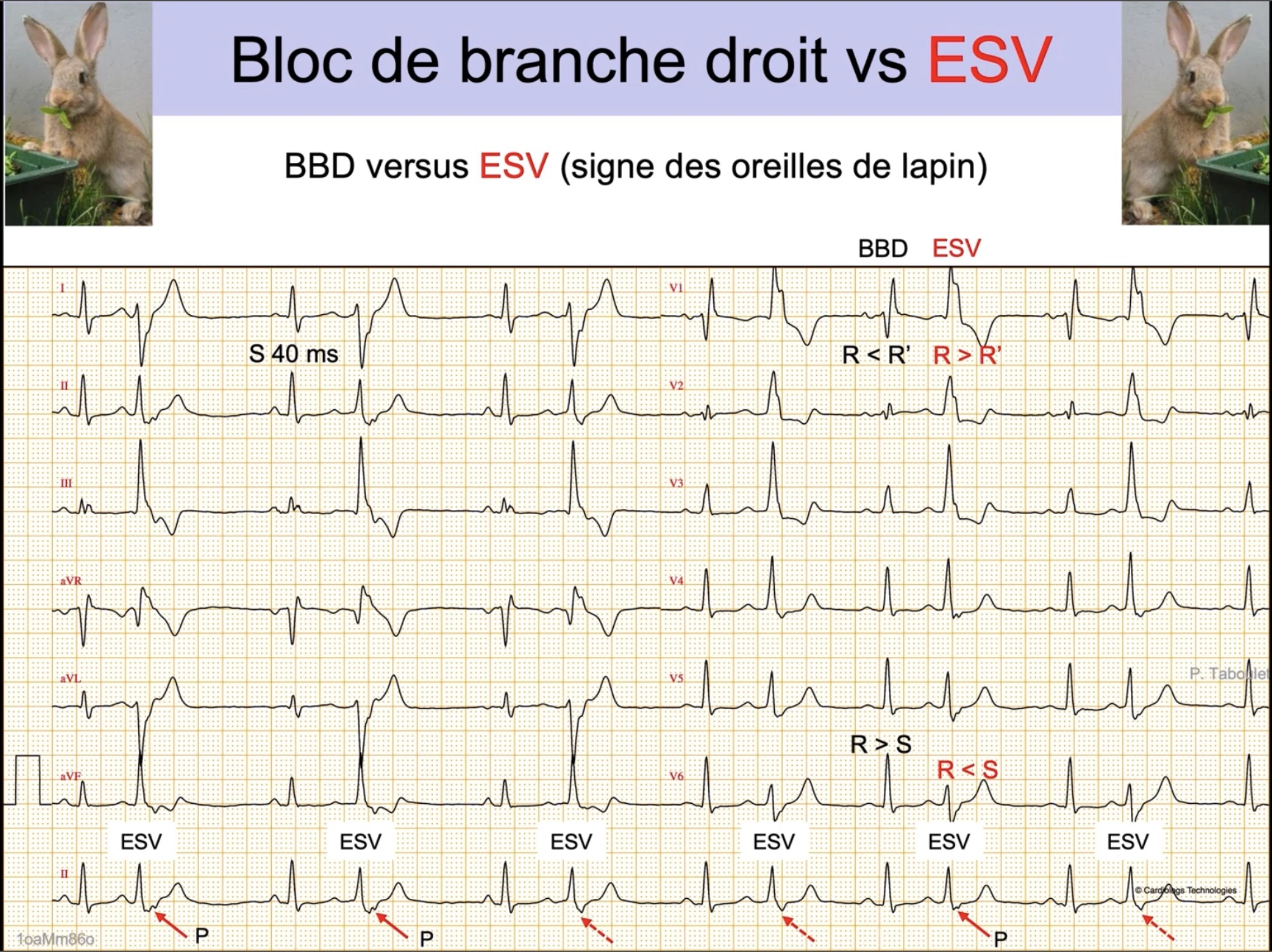 BBD vs ESV — oreilles de lapin