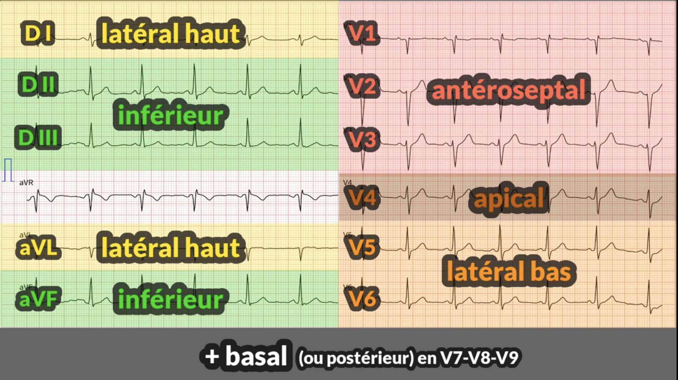 ECG territoires — cartographie des 12 dérivations