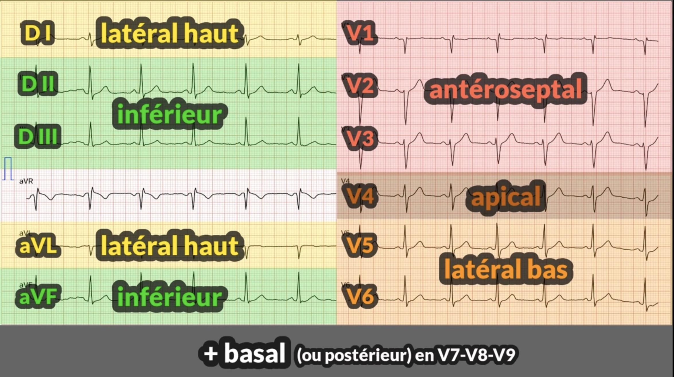 ECG territoires — cartographie des 12 dérivations
