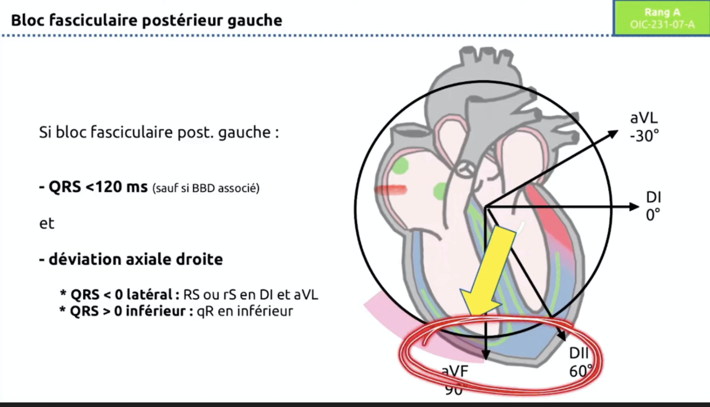 HBPG — schéma vecteur axe droit
