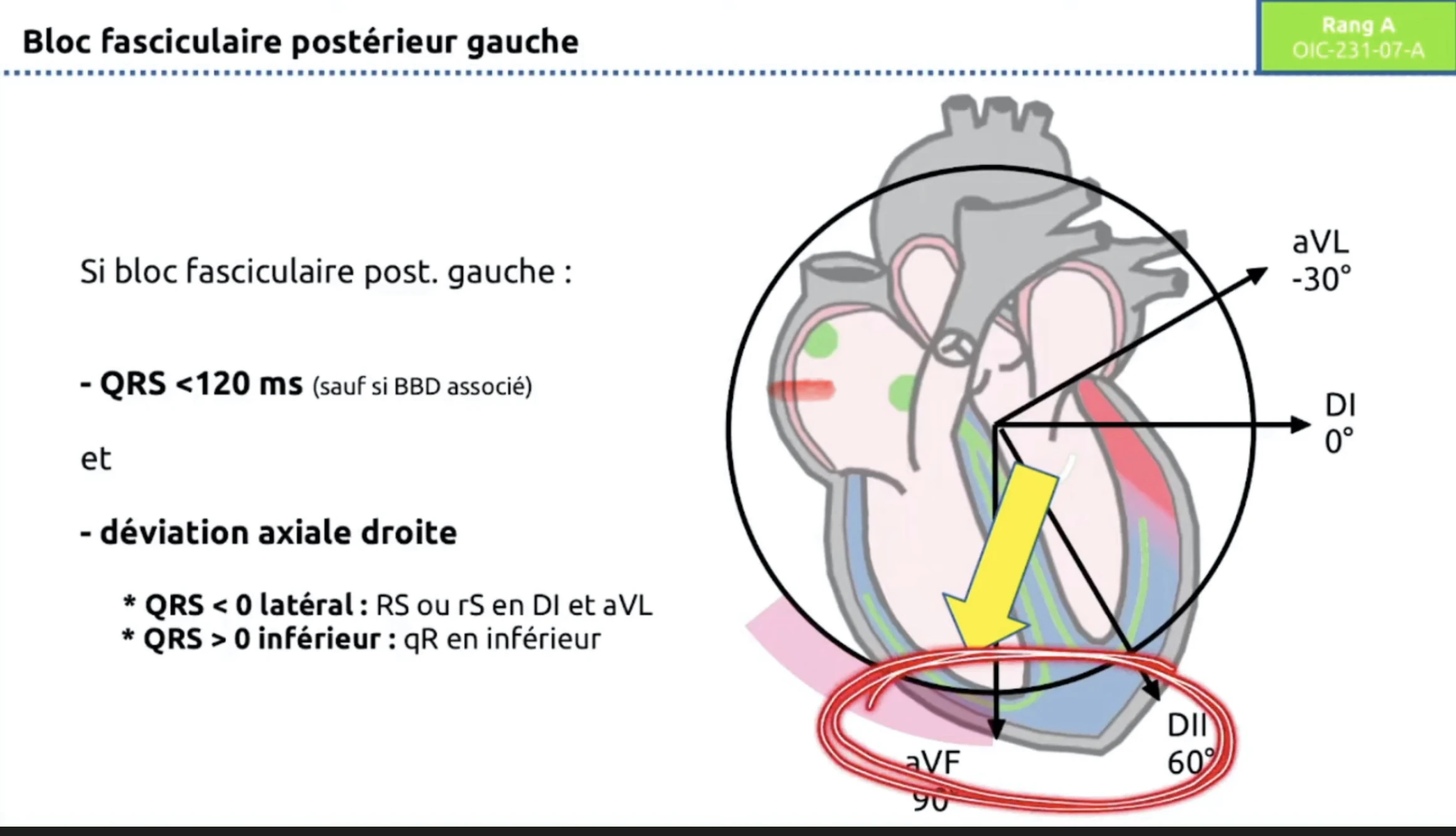 HBPG — schéma vecteur axe droit